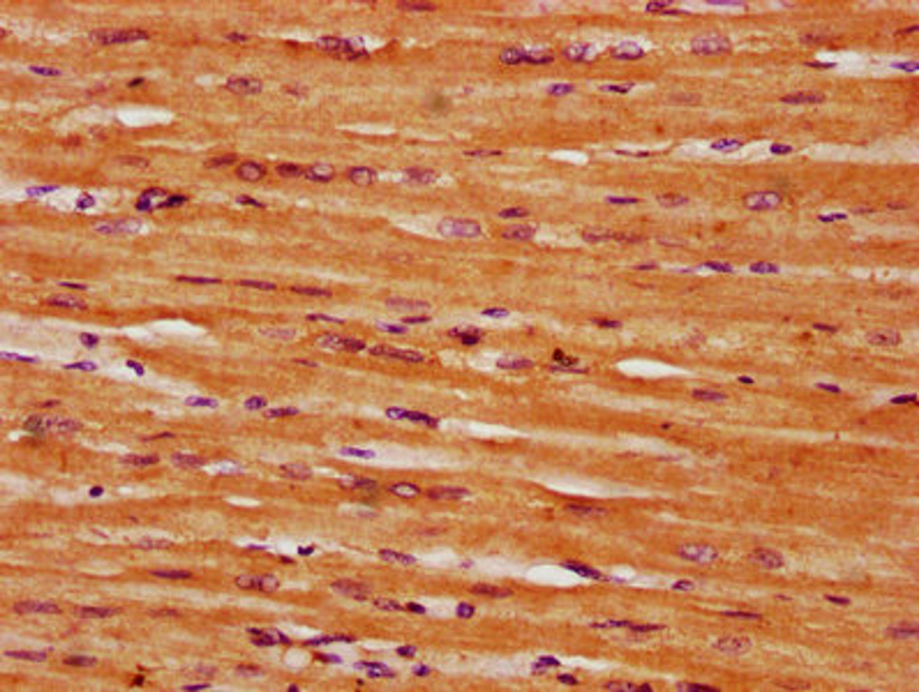 IHC image of CSB-PA020835LA01HU diluted at 1:300 and staining in paraffin-embedded human heart tissue performed on a Leica BondTM system. After dewaxing and hydration, antigen retrieval was mediated by high pressure in a citrate buffer (pH 6.0). Section was blocked with 10% normal goat serum 30min at RT. Then primary antibody (1% BSA) was incubated at 4&deg;C overnight. The primary is detected by a biotinylated secondary antibody and visualized using an HRP conjugated SP system.