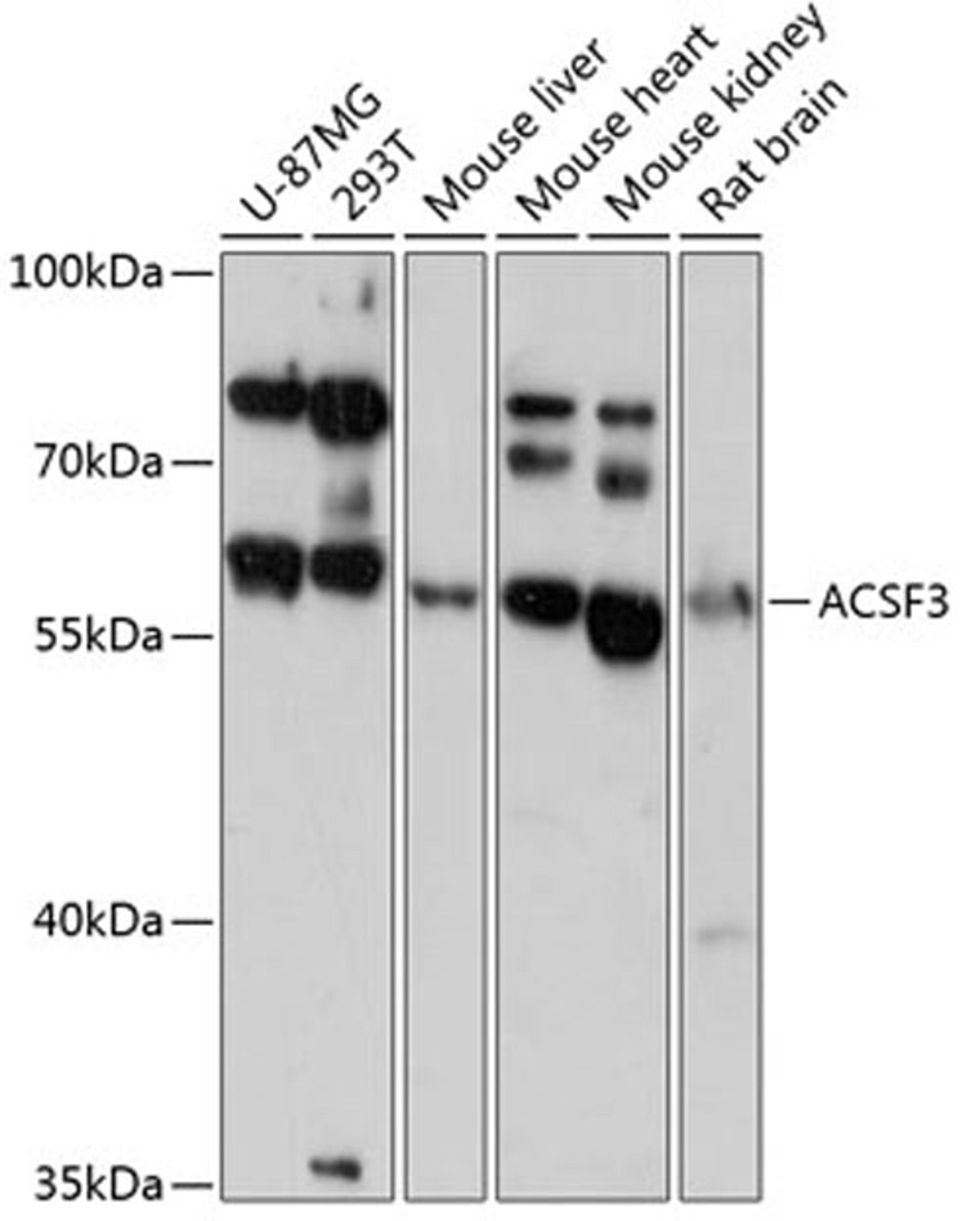 Western blot - ACSF3 antibody (A13769)