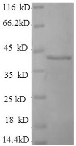 (Tris-Glycine gel) Discontinuous SDS-PAGE (reduced) with 5% enrichment gel and 15% separation gel.