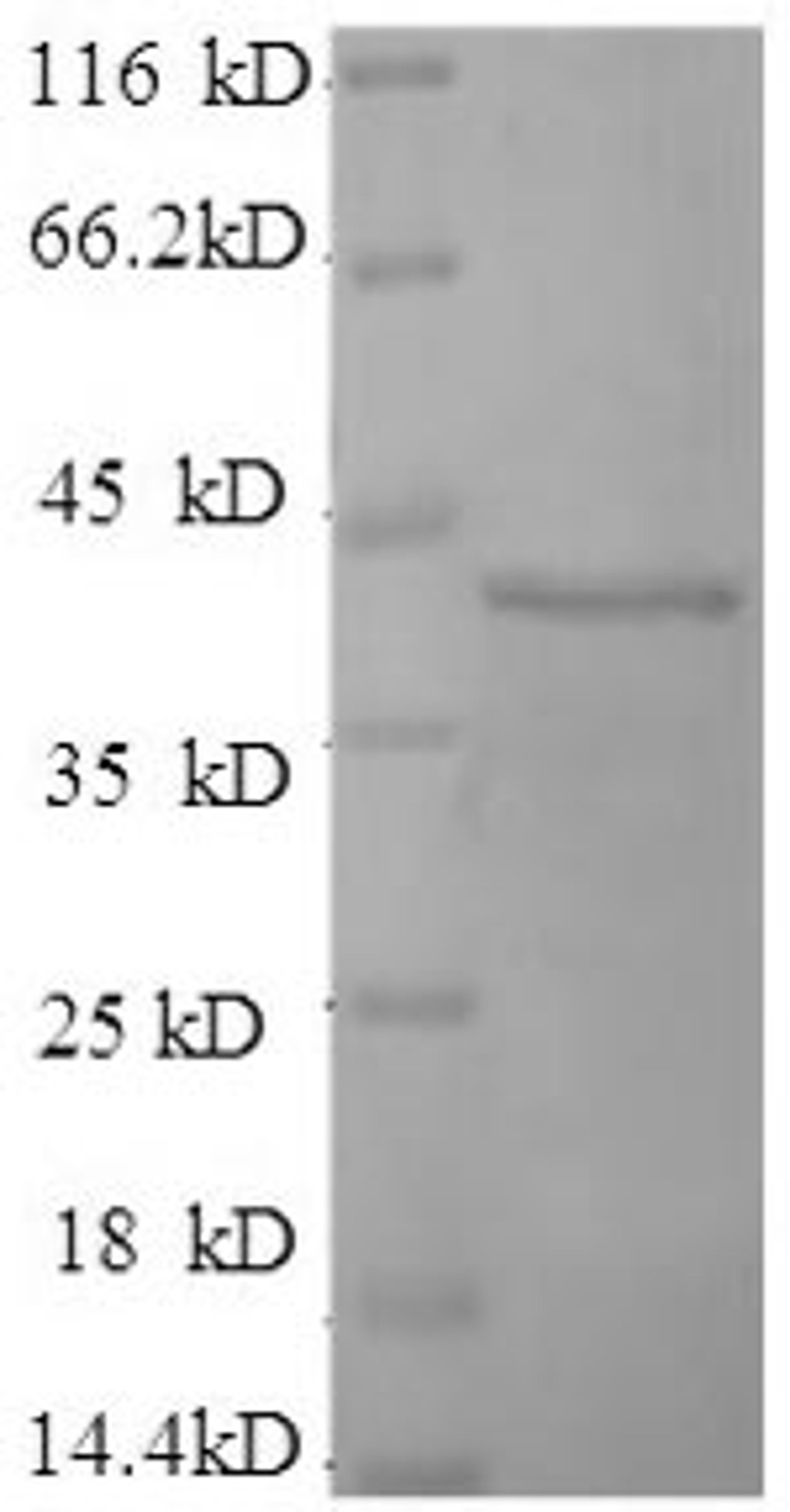 (Tris-Glycine gel) Discontinuous SDS-PAGE (reduced) with 5% enrichment gel and 15% separation gel.