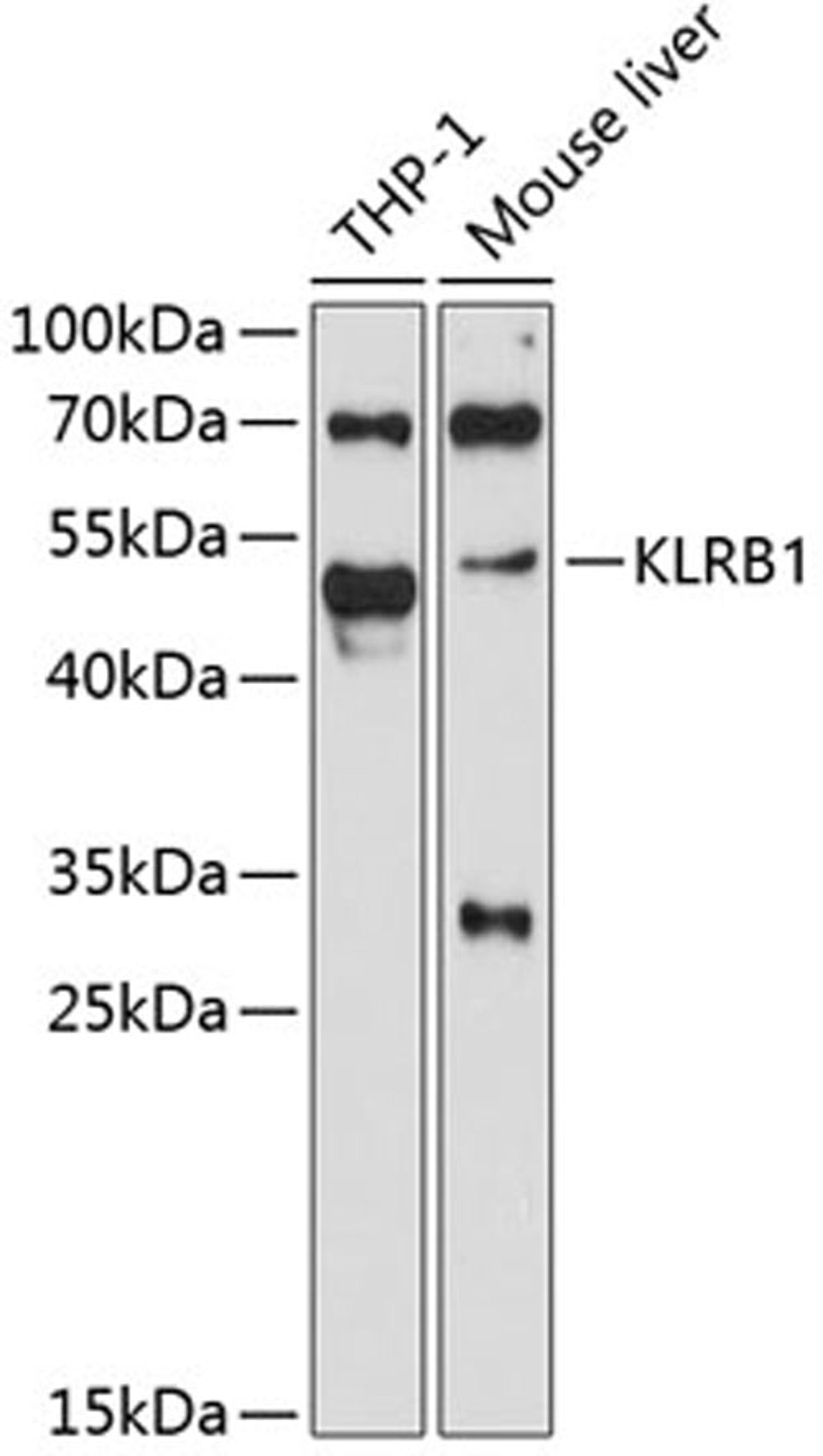 Western blot - KLRB1 antibody (A11783)