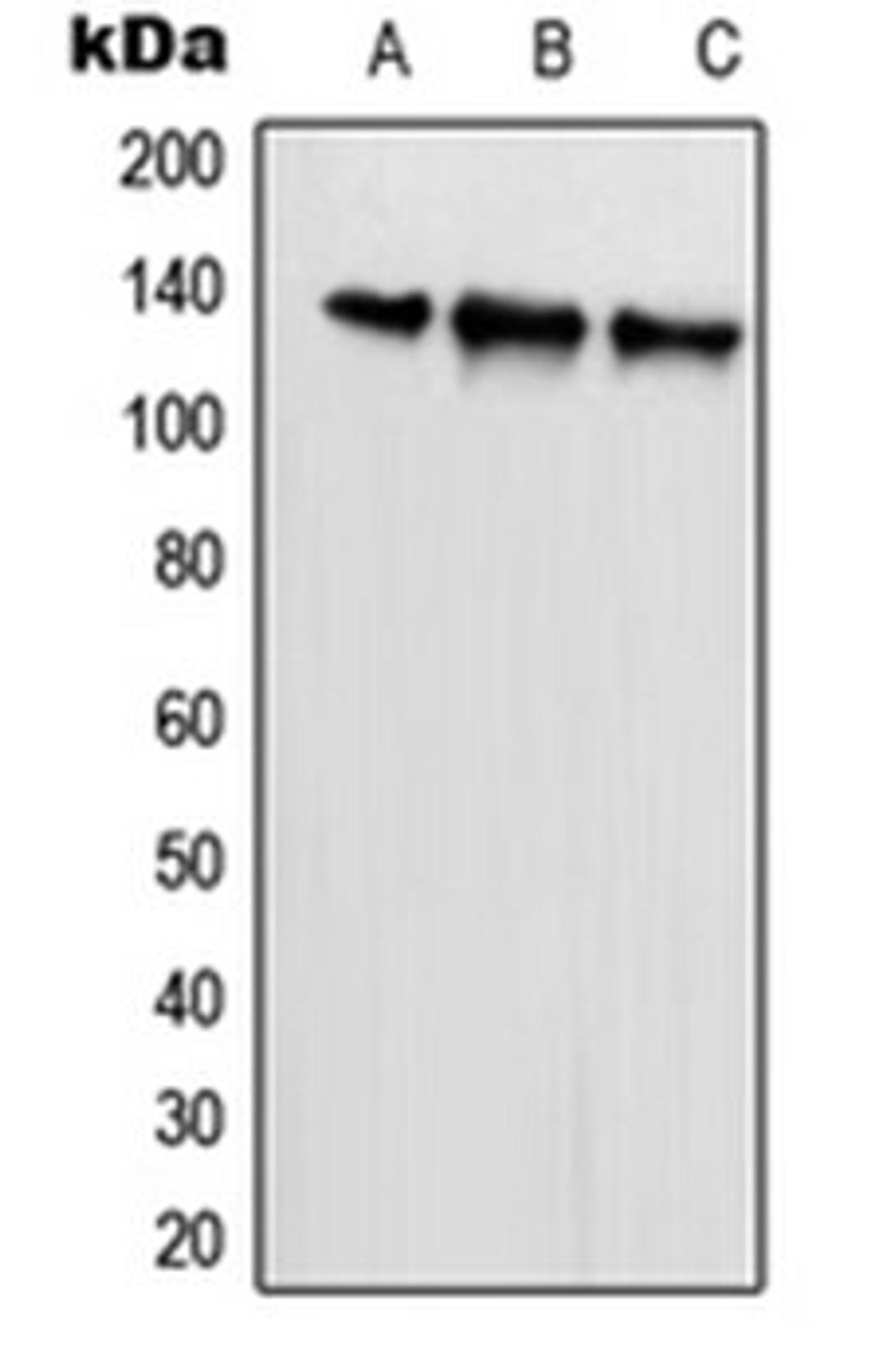 Western blot analysis of HeLa (Lane 1), U2OS (Lane 2), NIH3T3 (Lane 3) whole cell lysates using SCAF1 antibody