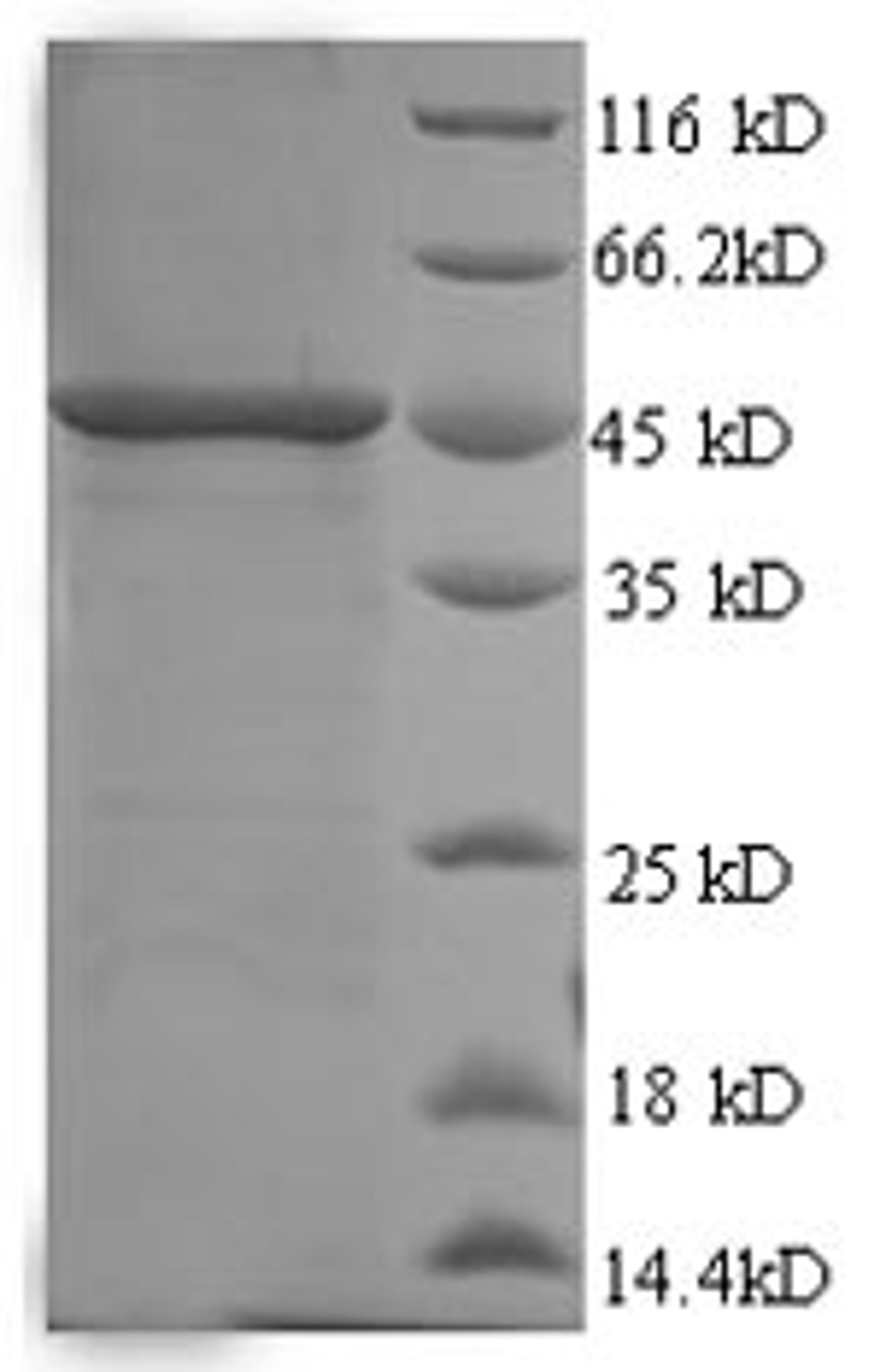 (Tris-Glycine gel) Discontinuous SDS-PAGE (reduced) with 5% enrichment gel and 15% separation gel.