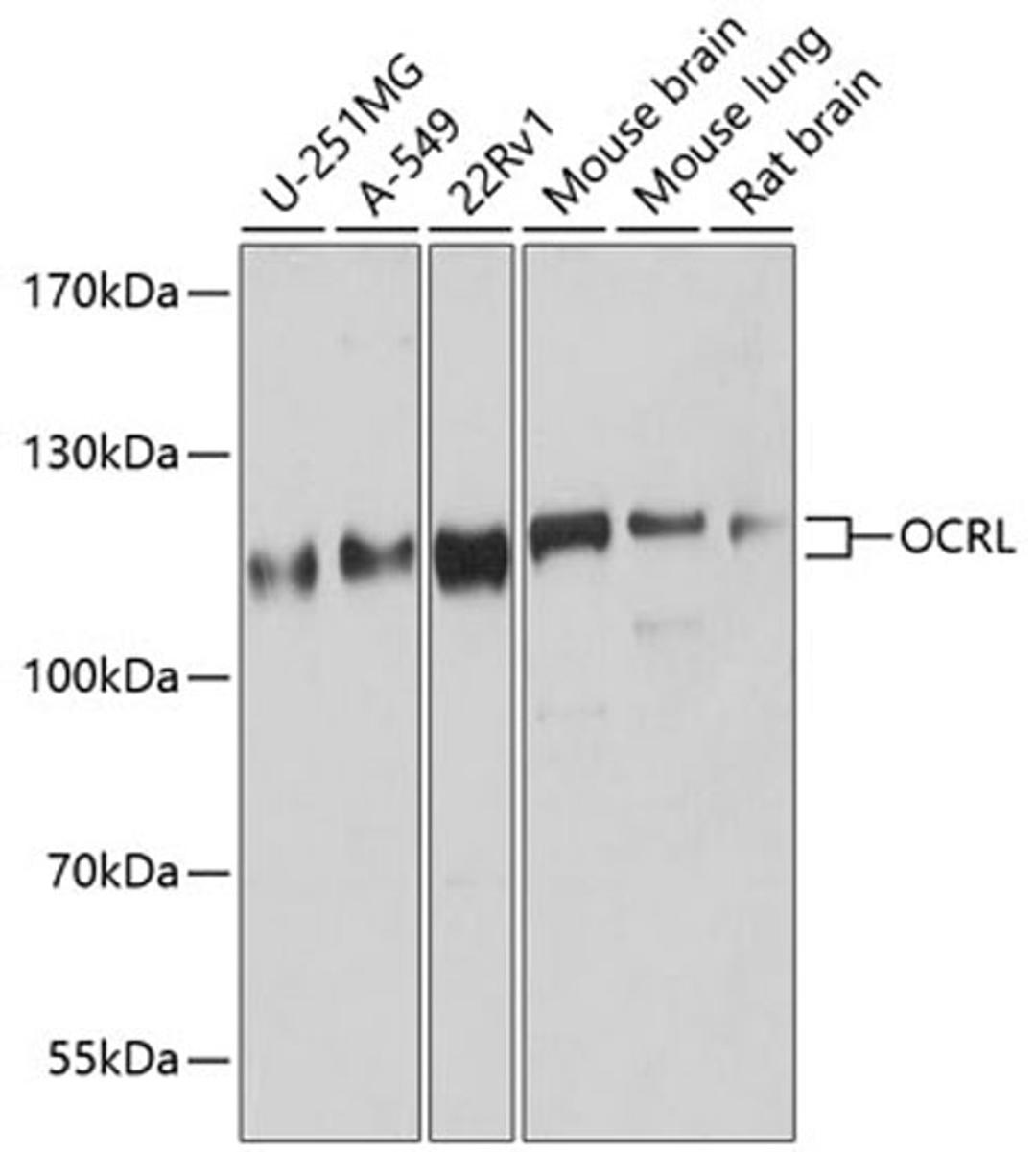 Western blot - OCRL antibody (A9290)