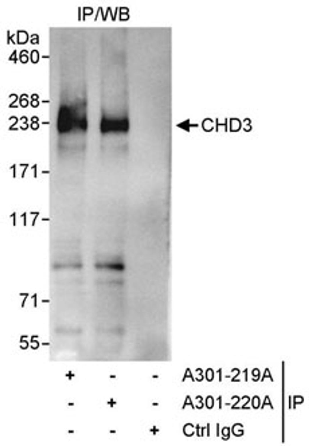 Detection of human CHD3 by western blot of immunoprecipitates.