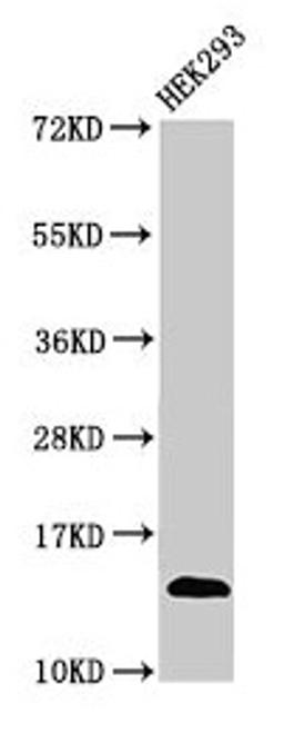 Western Blot. Positive WB detected in: HEK293 whole cell lysate. All lanes: TRBV7-9 antibody at 3µg/ml. Secondary. Goat polyclonal to rabbit IgG at 1/50000 dilution. Predicted band size: 14 kDa. Observed band size: 14 kDa