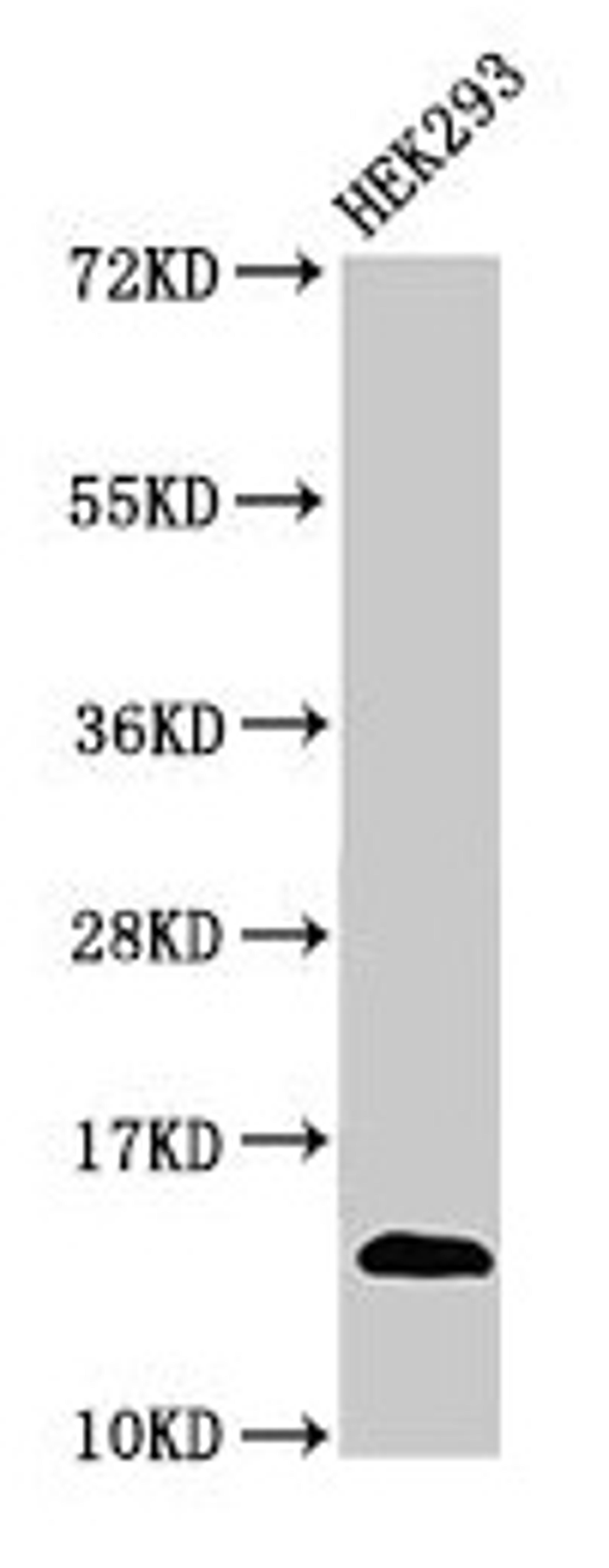 Western Blot. Positive WB detected in: HEK293 whole cell lysate. All lanes: TRBV7-9 antibody at 3µg/ml. Secondary. Goat polyclonal to rabbit IgG at 1/50000 dilution. Predicted band size: 14 kDa. Observed band size: 14 kDa