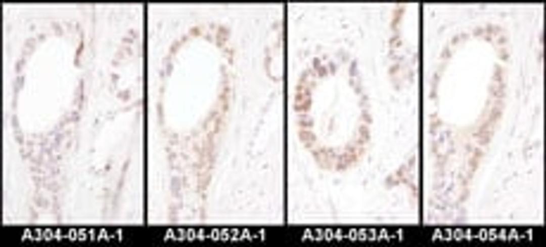 Detection of human HNF1-alpha by immunohistochemistry.