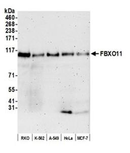 Detection of human FBXO11 by western blot.