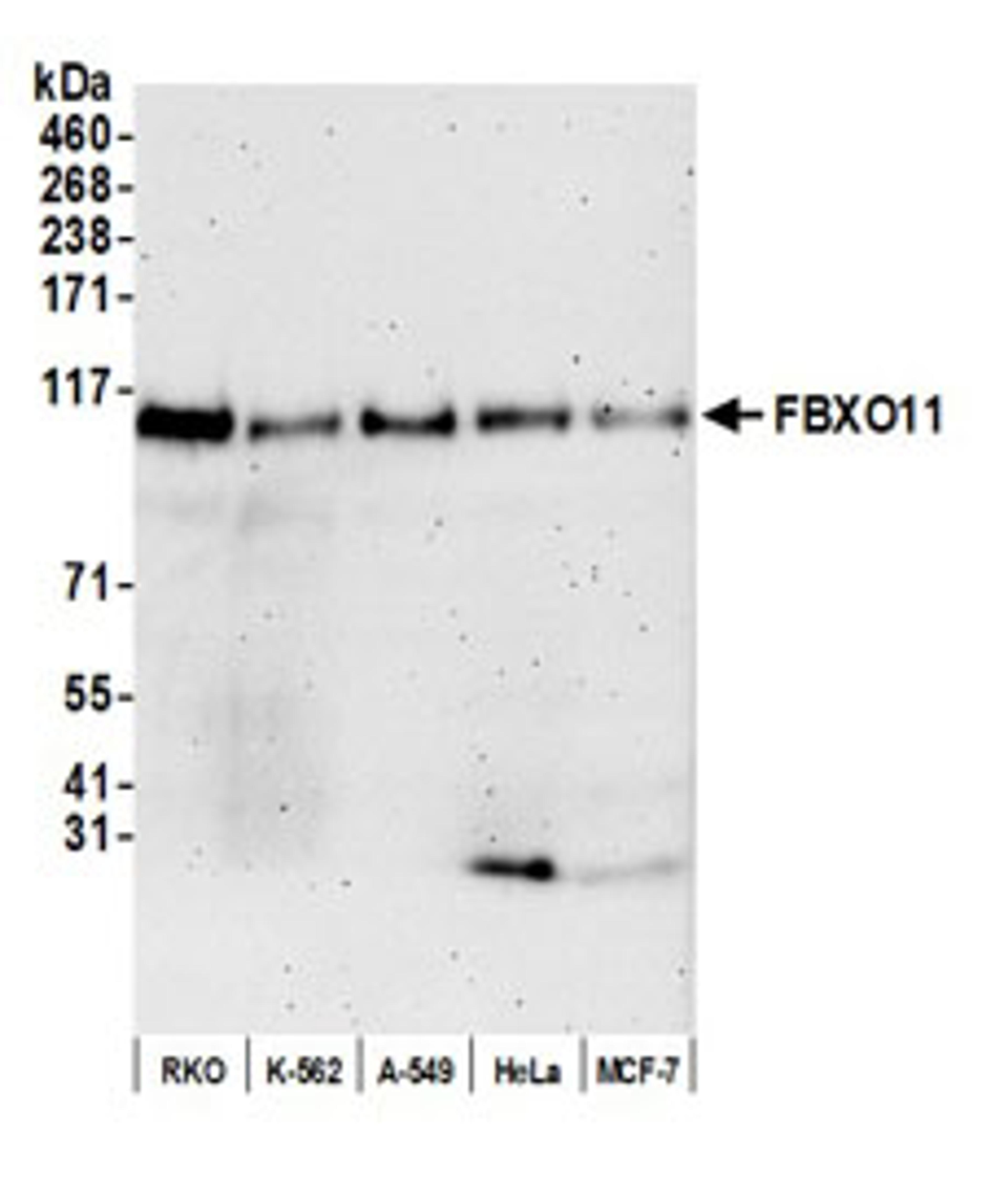 Detection of human FBXO11 by western blot.