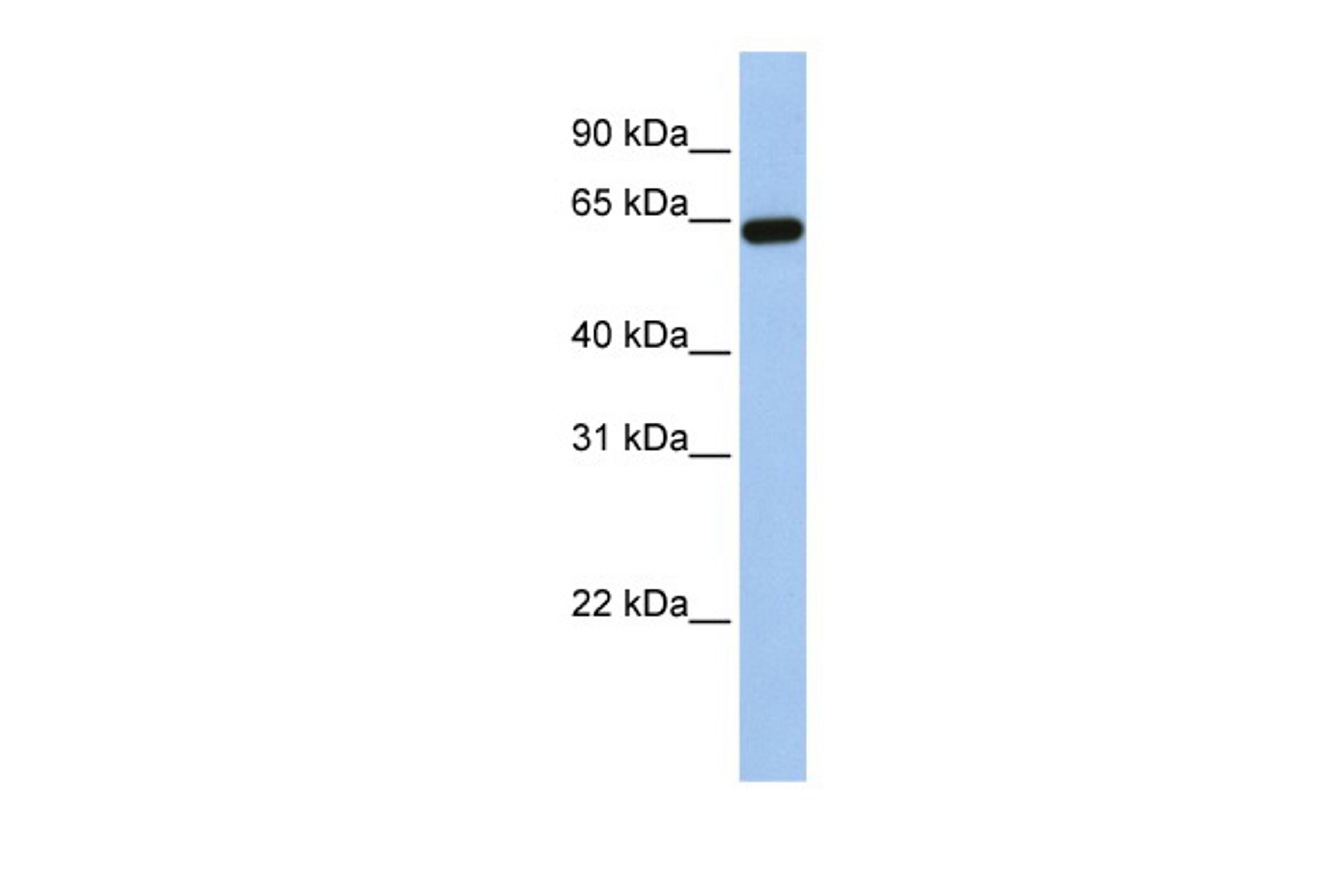 Antibody used in WB on Human Placenta at 0.2-1 ug/ml.