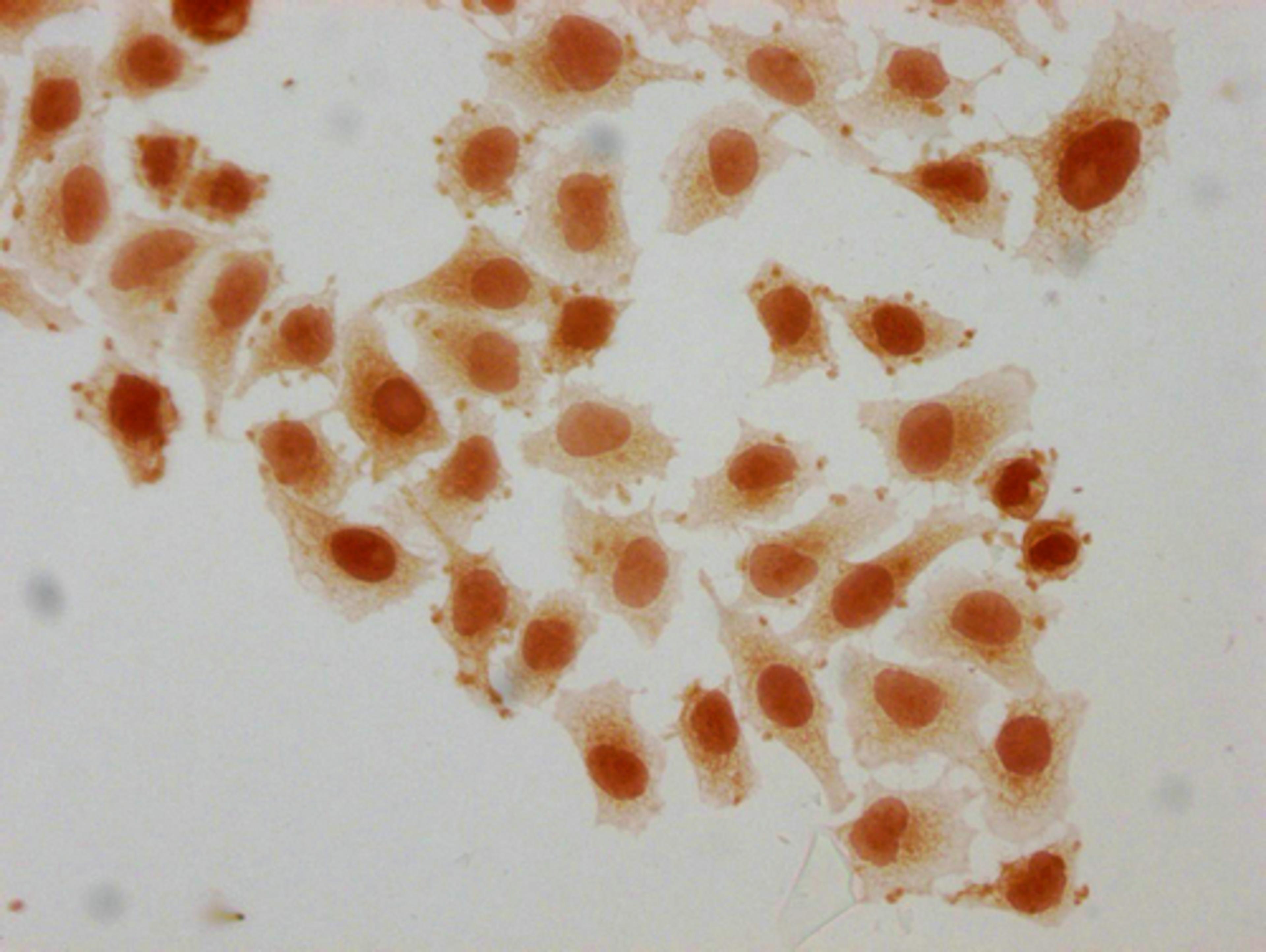 Immunocytochemistry analysis of CSB-PA010389PA95sucHU diluted at 1:10 and staining in Hela cells(treated with 10mM disodium succinylate for 4h) performed on a Leica BondTM system. The cells were fixed in 4% formaldehyde, permeabilized using 0.2% Triton X-100 and blocked with 10% normal goat serum 30min at RT. Then primary antibody (1% BSA) was incubated at 4°C overnight. The primary is detected by a biotinylated secondary antibody and visualized using an HRP conjugated SP system.