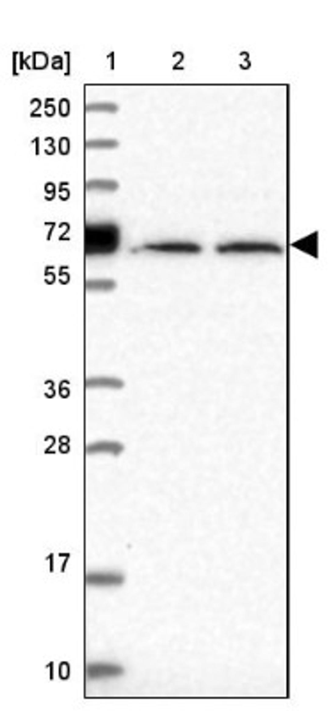 Western Blot: Uromodulin Antibody [NBP2-33393] - Lane 1: Marker [kDa] 250, 130, 95, 72, 55, 36, 28, 17, 10<br/>Lane 2: Human cell line RT-4<br/>Lane 3: Human cell line U-251MG