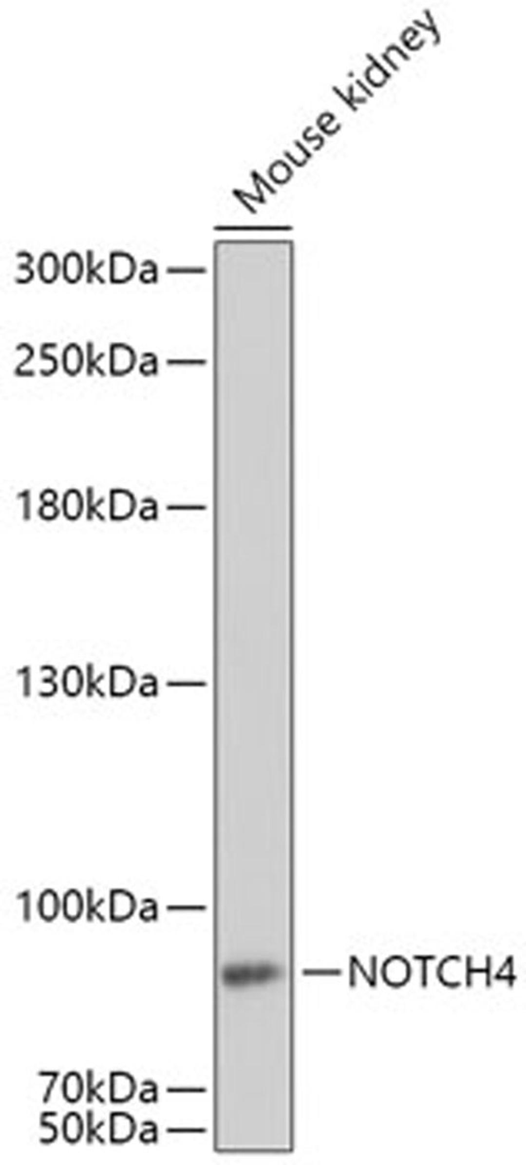 Western blot - NOTCH4 antibody (A8303)