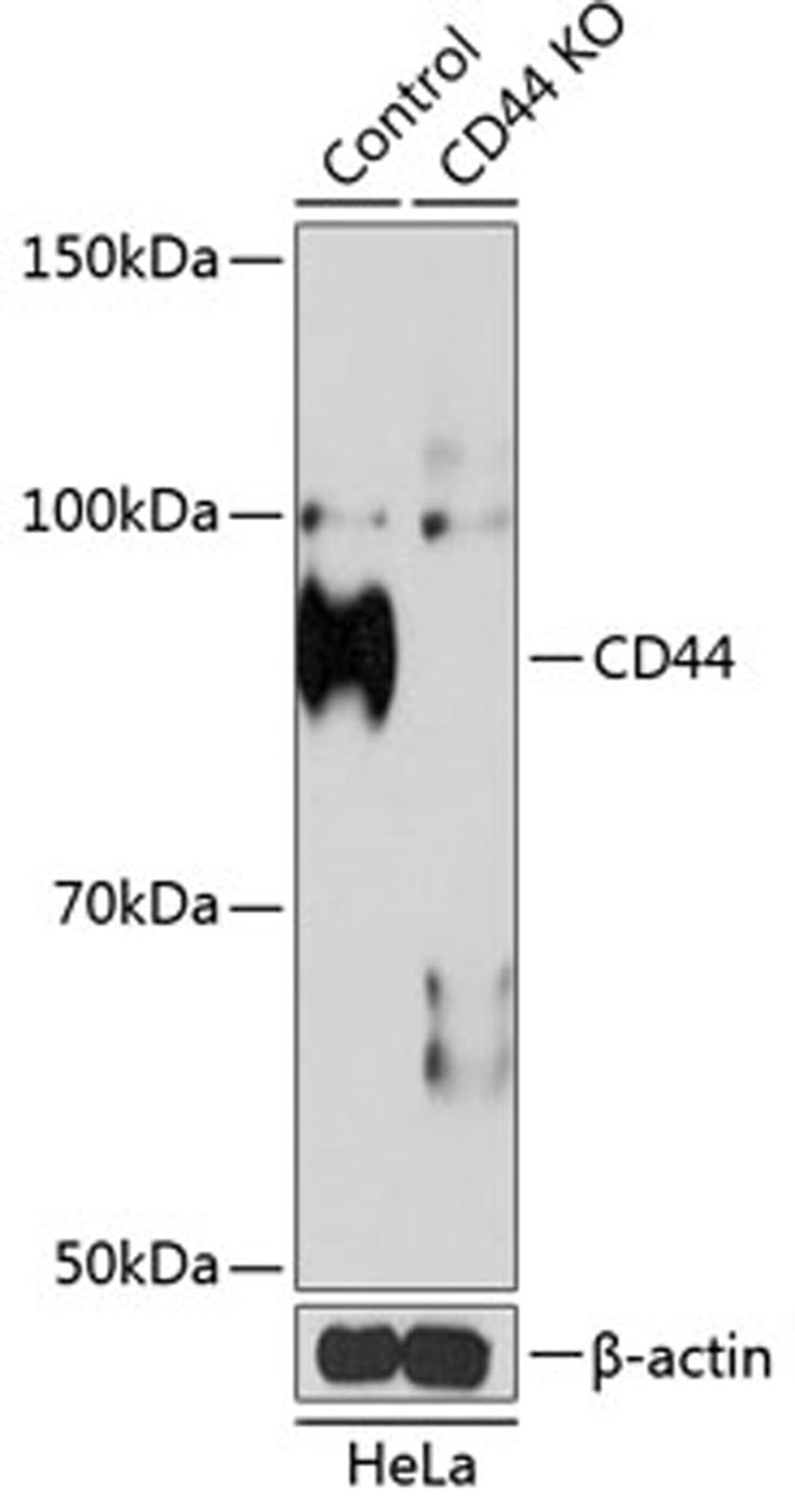 Western blot - CD44 antibody (A19020)