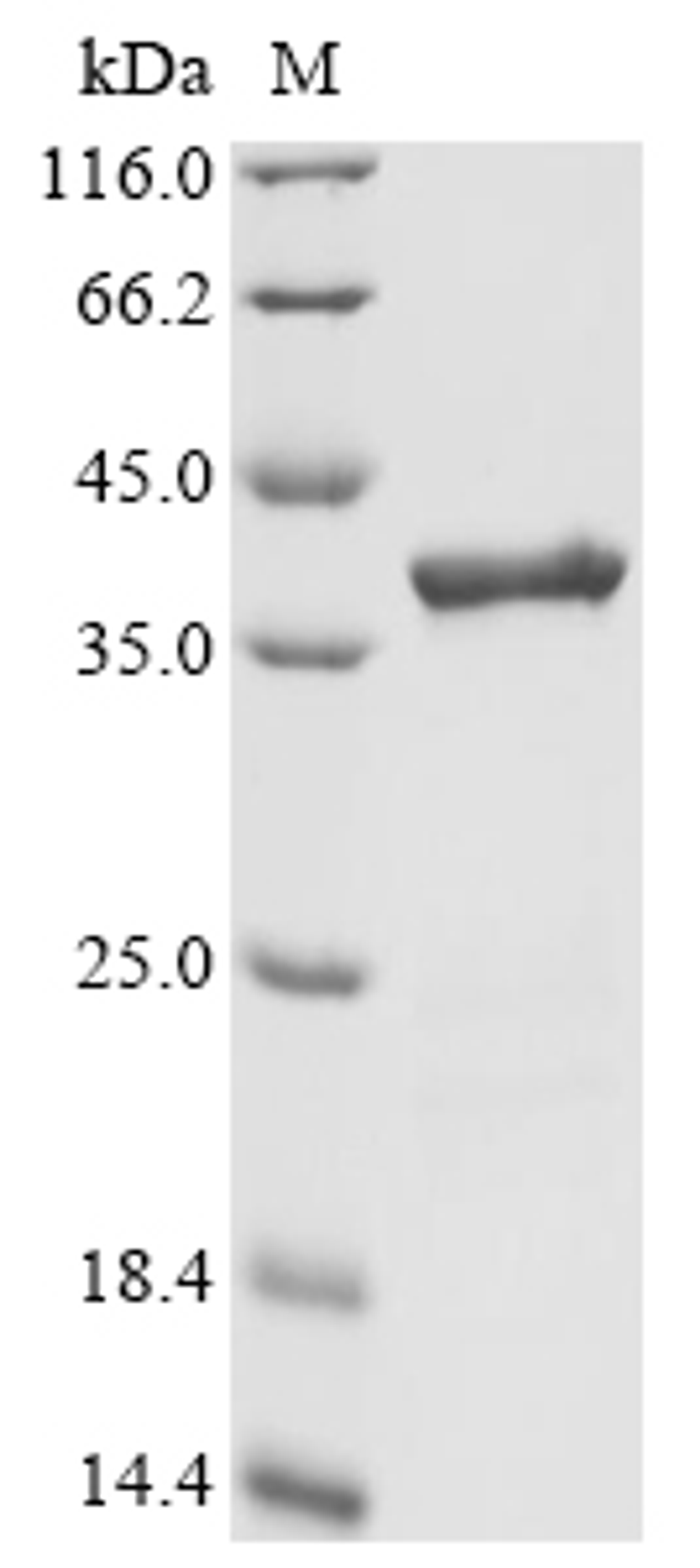 (Tris-Glycine gel) Discontinuous SDS-PAGE (reduced) with 5% enrichment gel and 15% separation gel.