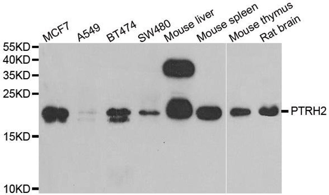 Western blot analysis of extracts of various cell lines using PTRH2 antibody