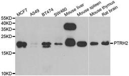 Western blot analysis of extracts of various cell lines using PTRH2 antibody