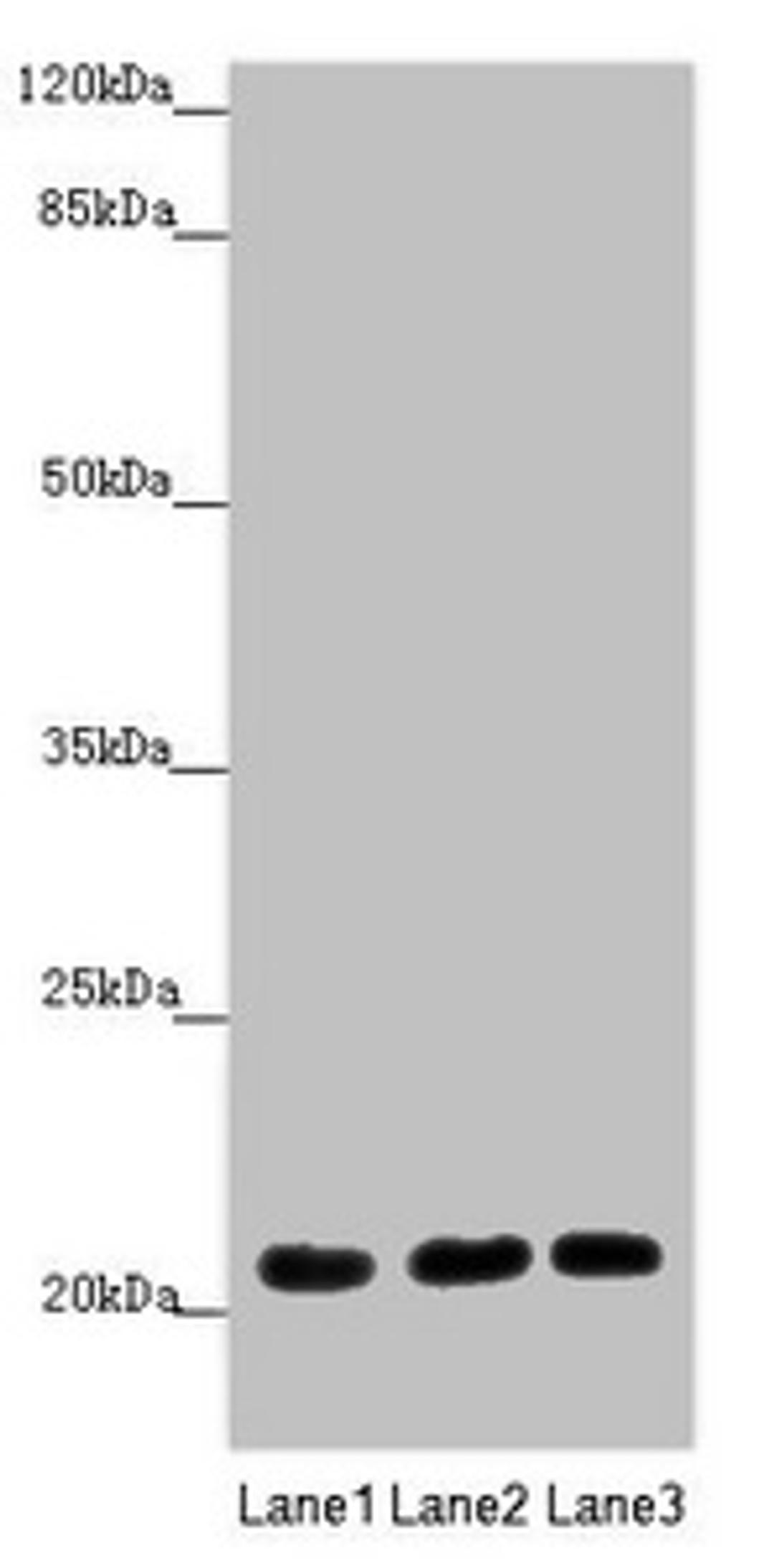 Western blot. All lanes: MOCS2 antibody at 1.68 ug/ml. Lane 1: A549 whole cell lysate. Lane 2: HepG2 whole cell lysate. Lane 3: Jurkat whole cell lysate. Secondary. Goat polyclonal to rabbit IgG at 1/10000 dilution. Predicted band size: 21 kDa. Observed band size: 21 kDa. 