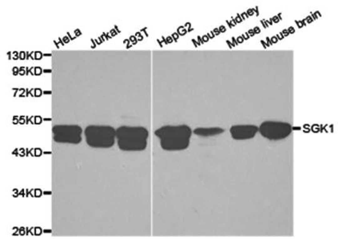 Western blot analysis of extracts of various cell lines lysates using SGK1 antibody