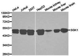 Western blot analysis of extracts of various cell lines lysates using SGK1 antibody