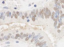 Detection of human CSTF2T/TauCSTF64 by immunohistochemistry.