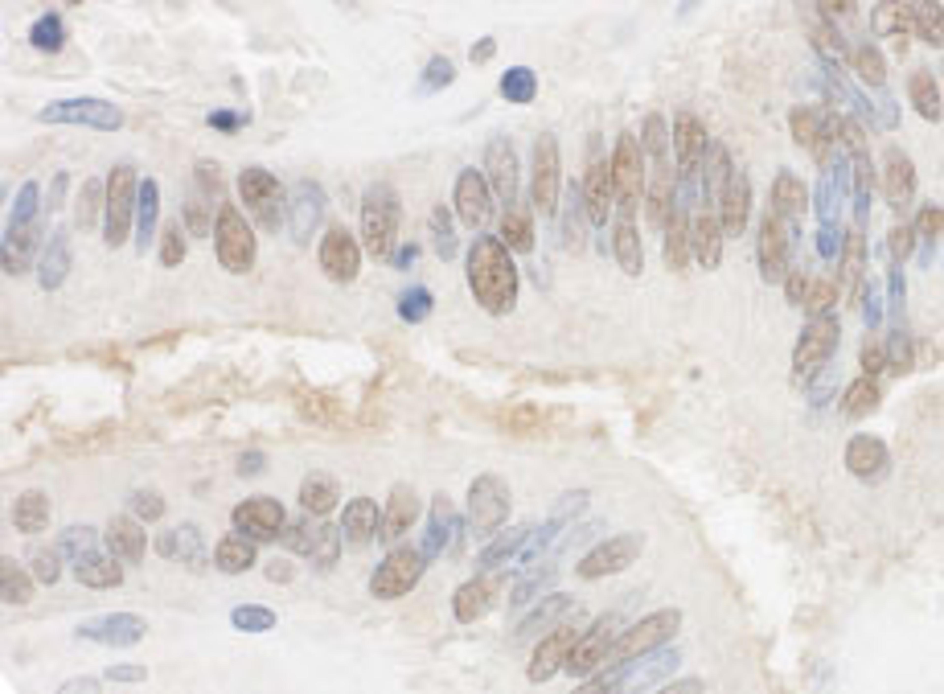 Detection of human CSTF2T/TauCSTF64 by immunohistochemistry.