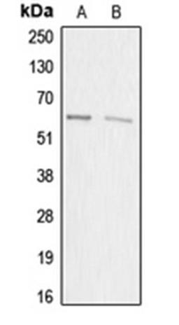 Western blot analysis of HEK293T (Lane 1), HeLa (Lane 2) whole cell lysates using ACRBP antibody