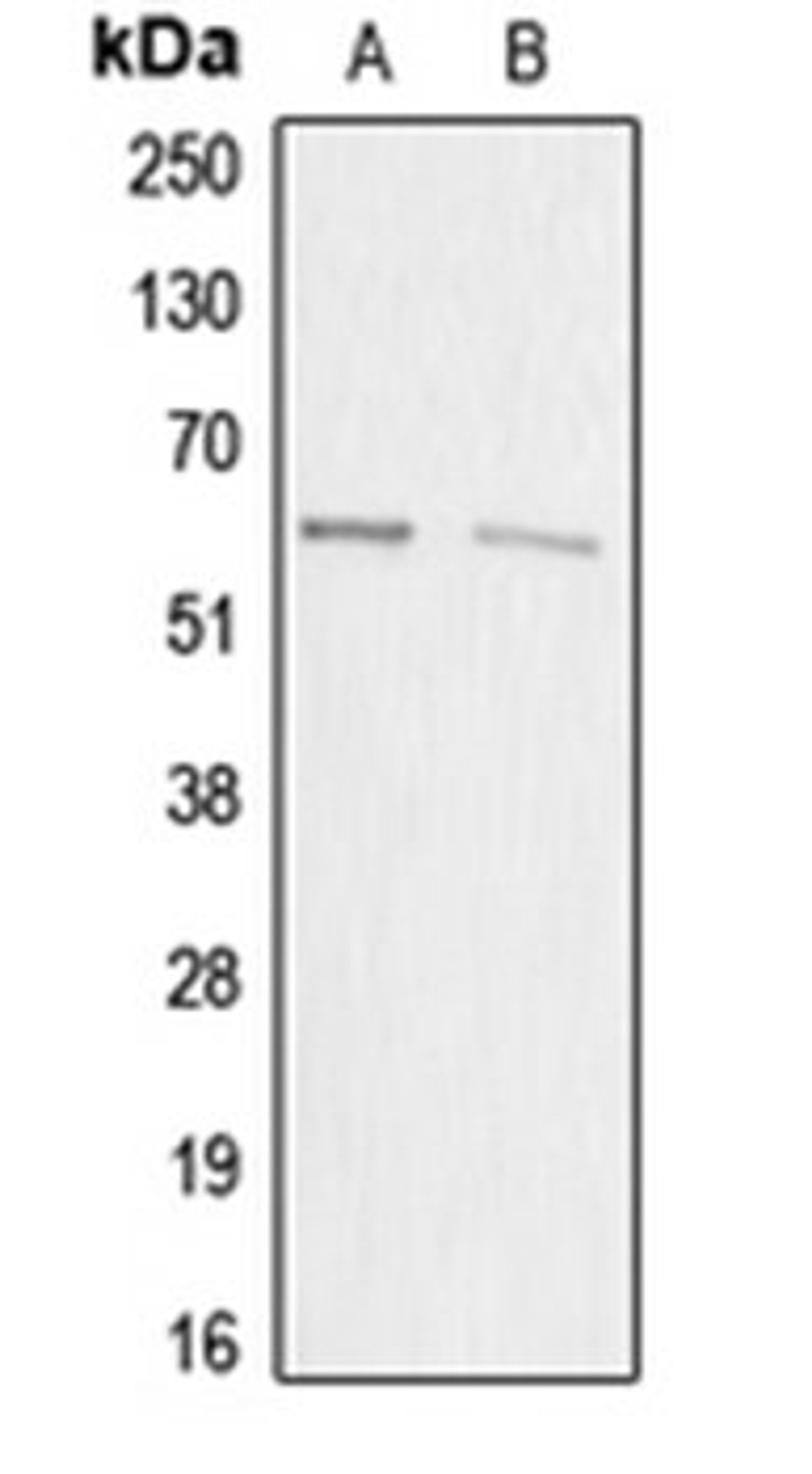 Western blot analysis of HEK293T (Lane 1), HeLa (Lane 2) whole cell lysates using ACRBP antibody