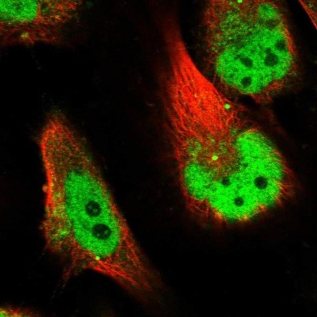 Immunocytochemistry/Immunofluorescence: SLC38A9 Antibody [NBP1-92403] - Staining of human cell line U-251 MG shows positivity in nucleus but not nucleoli & vesicles.