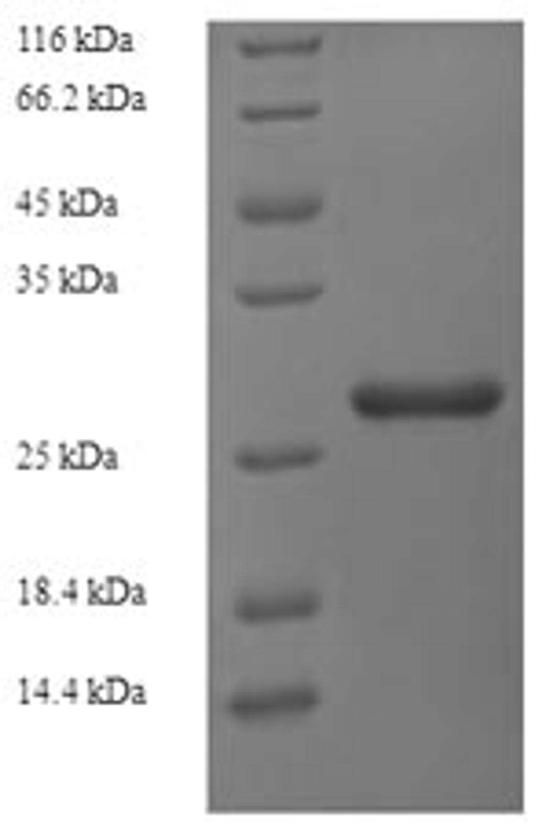 (Tris-Glycine gel) Discontinuous SDS-PAGE (reduced) with 5% enrichment gel and 15% separation gel.