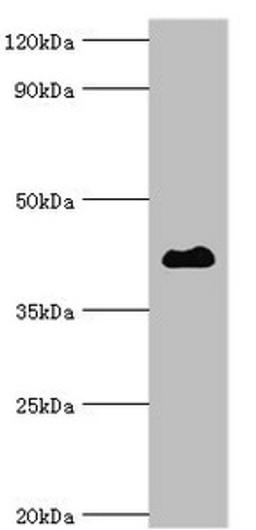 Western blot. Western blot. All lanes: Histone deacetylase 8 antibody at 2ug/ml + Hela whole cell lysate. Secondary. Goat polyclonal to rabbit IgG at 1/10000 dilution. Predicted band size: 42, 30, 18, 32, 29, 16, 17 kDa. Observed band size: 42 kDa. 