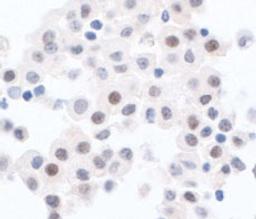 Detection of human PPP1CA by immunohistochemistry.