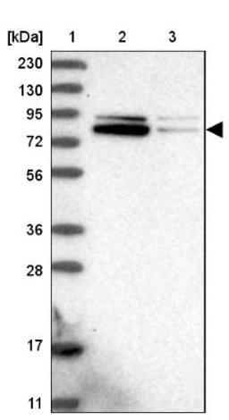 Western Blot: ZNF507 Antibody [NBP1-82932] - Lane 1: Marker [kDa] 230, 130, 95, 72, 56, 36, 28, 17, 11<br/>Lane 2: Human cell line RT-4<br/>Lane 3: Human cell line U-251MG sp