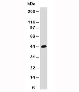 Western blot testing of HCT116 cell lysate and EpCAM antibody (EPM17-1).