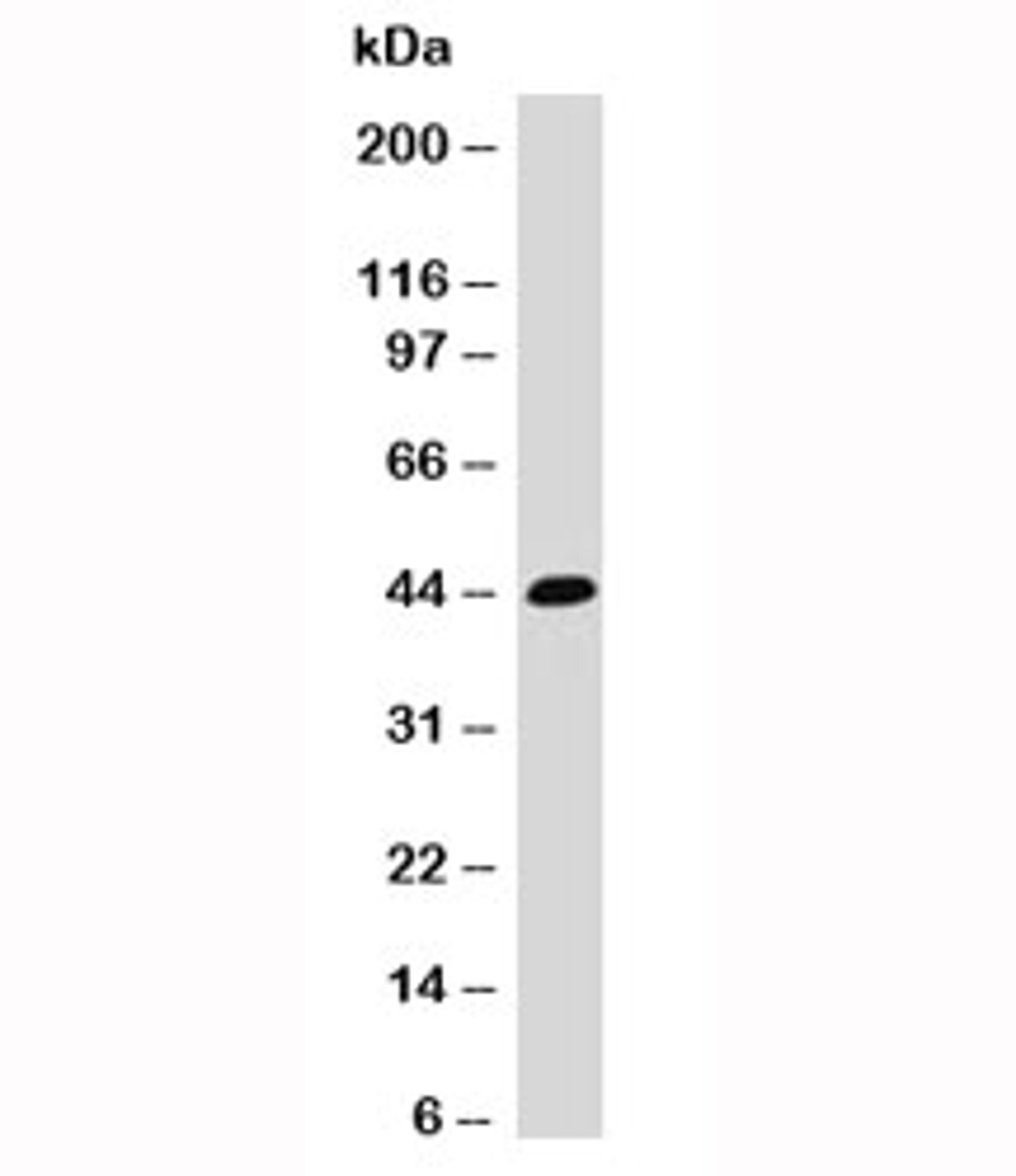 Western blot testing of HCT116 cell lysate and EpCAM antibody (EPM17-1).