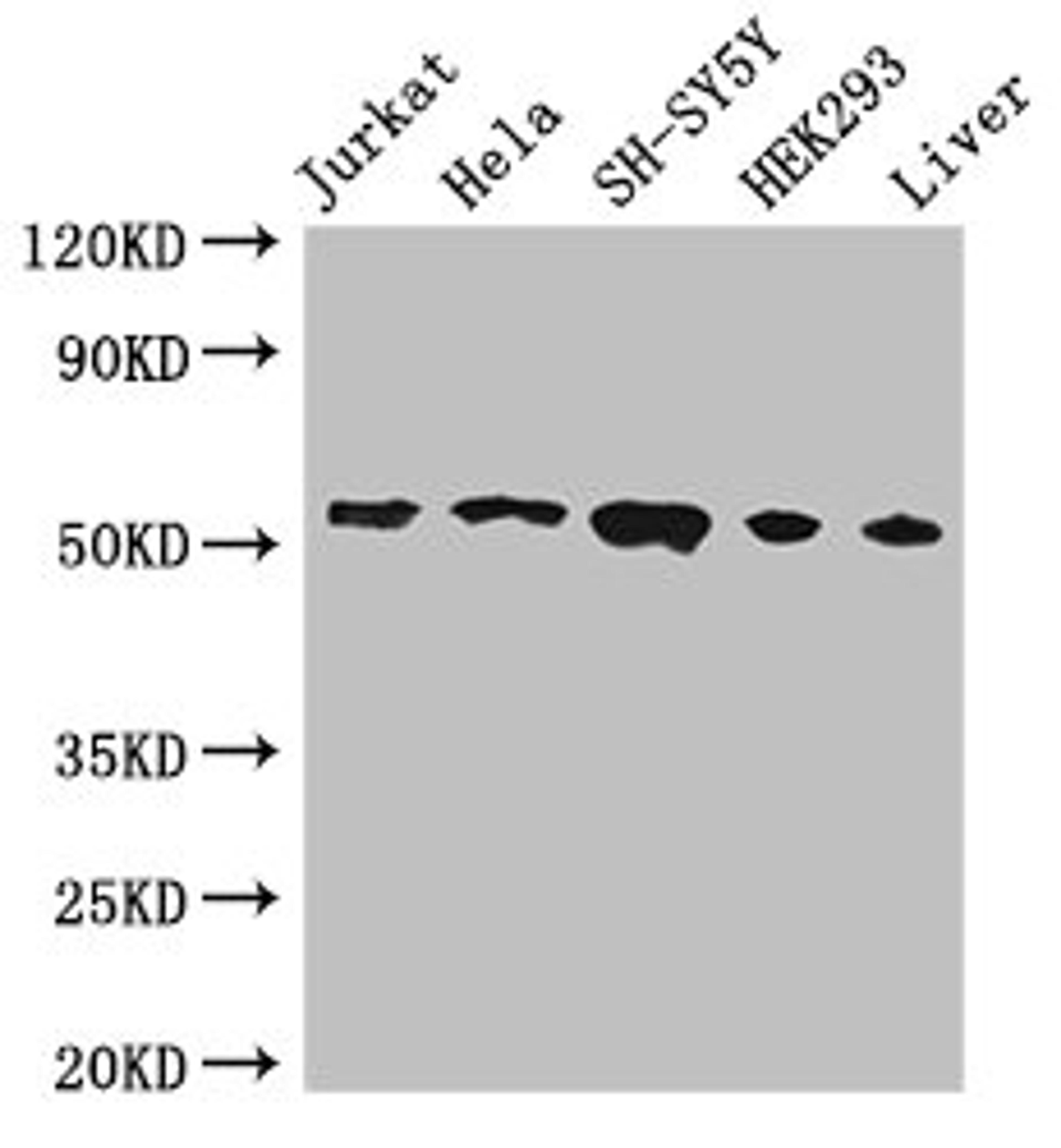 Western Blot. Positive WB detected in: Jurkat whole cell lysate, Hela whole cell lysate, SH-SY5Y whole cell lysate, HEK293 whole cell lysate, Mouse liver tissue. All lanes: FKBP8 antibody at 3ug/ml. Secondary. Goat polyclonal to rabbit IgG at 1/50000 dilution. Predicted band size: 45, 28 kDa. Observed band size: 55 kDa. 