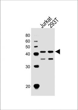 Western Blot at 1:1000 dilution Lane 1: Jurkat whole cell lysates Lane 2: 293T whole cell lysates Lysates/proteins at 20 ug per lane.