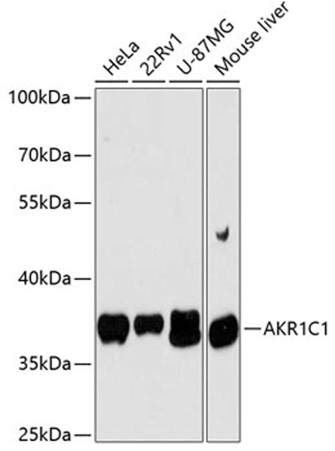 Western blot - AKR1C1 antibody (A13004)