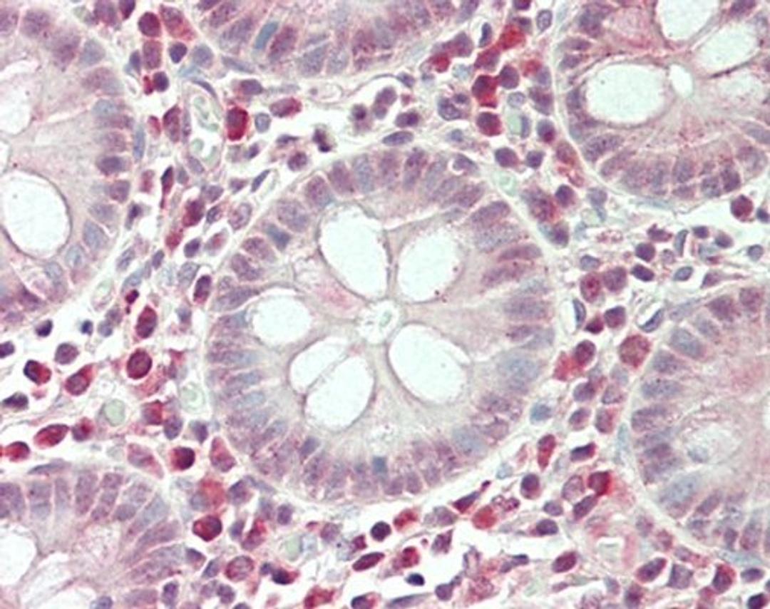 Immunohistochemical analysis of formalin-fixed and paraffin-embedded human Colontissue using SPON2 antibody