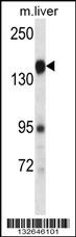 Western blot analysis in mouse liver tissue lysates (35ug/lane).