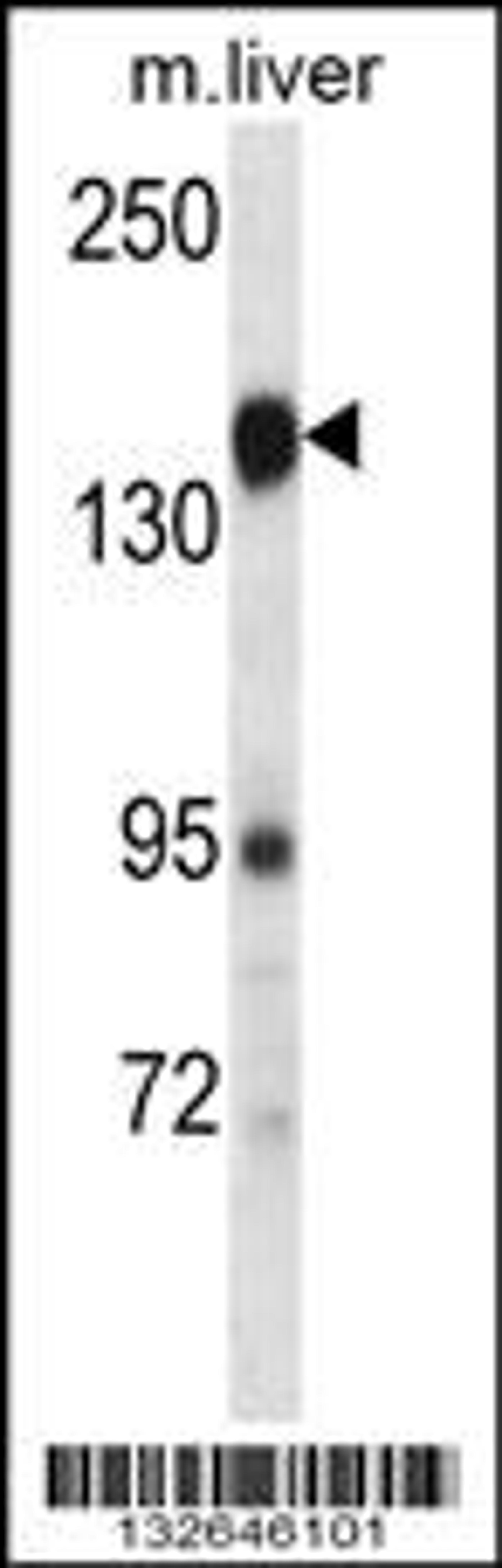 Western blot analysis in mouse liver tissue lysates (35ug/lane).