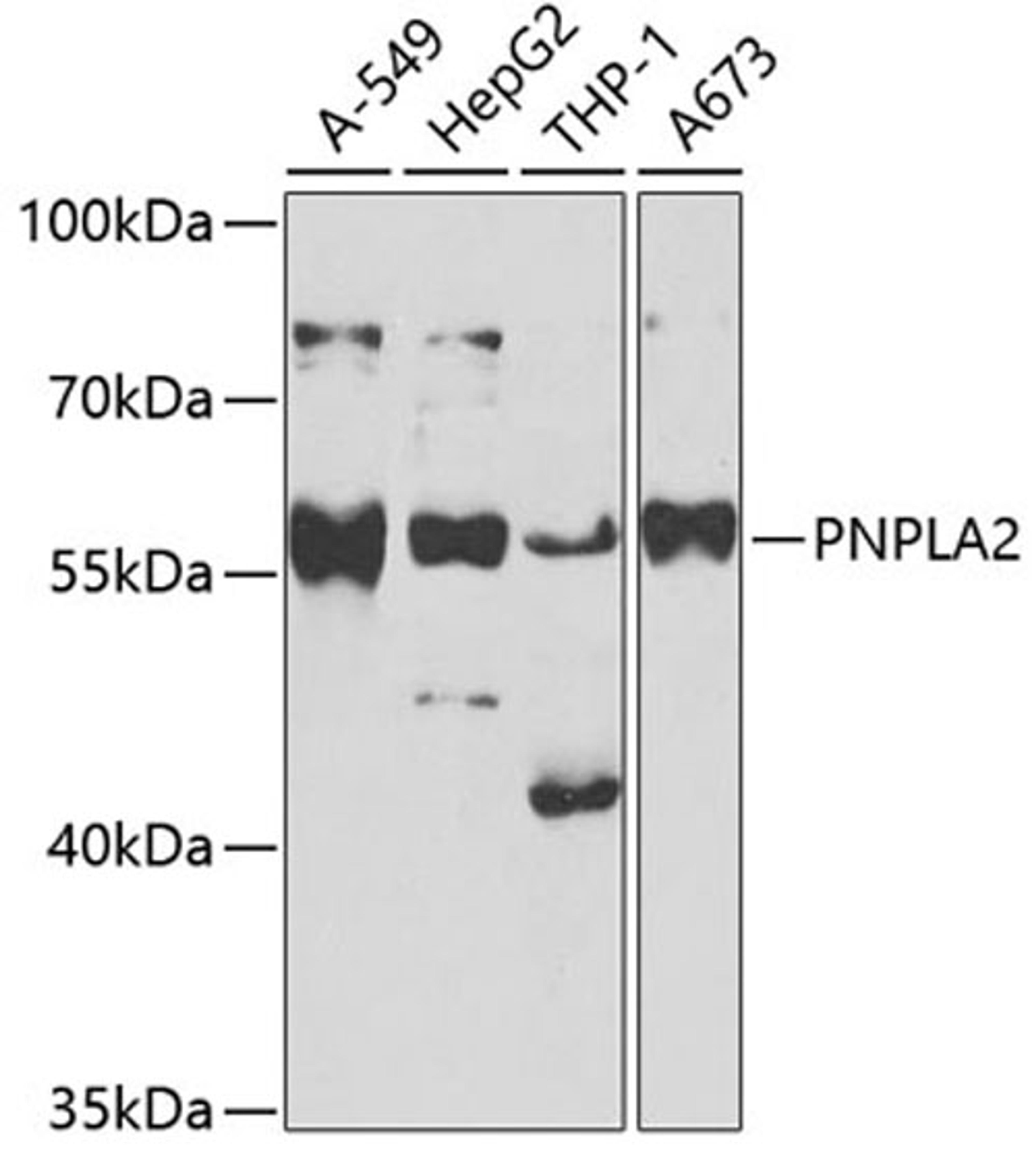 Western blot - PNPLA2 antibody (A6245)