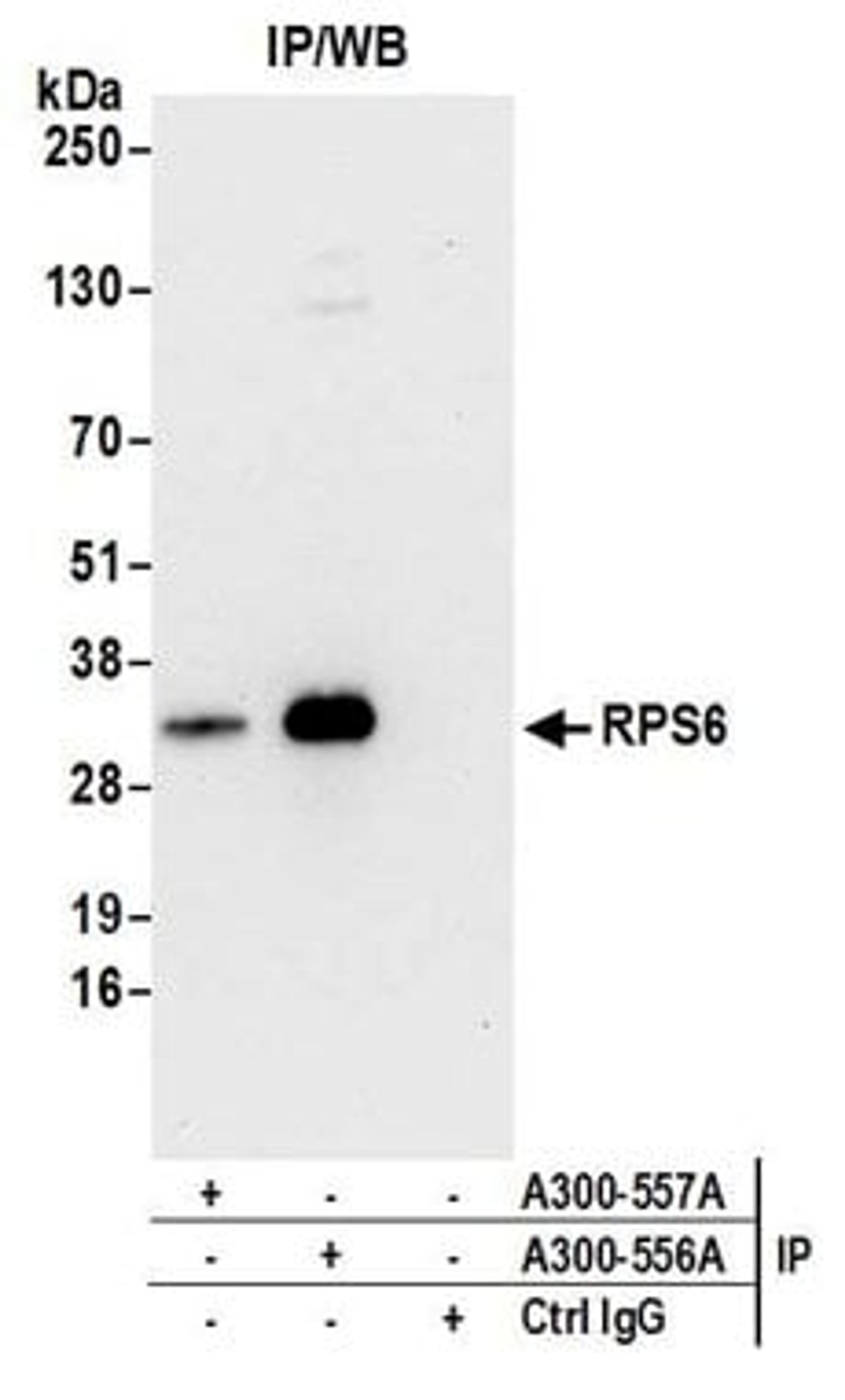 Detection of human RPS6 by western blot of immunoprecipitates.