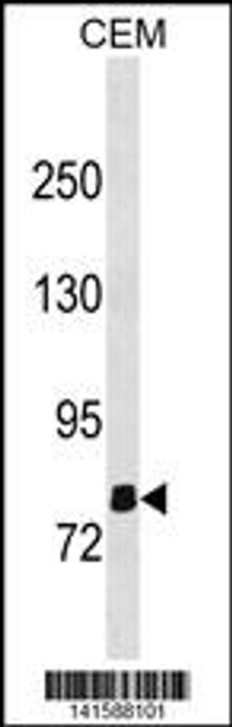 Western blot analysis in CEM cell line lysates (35ug/lane).