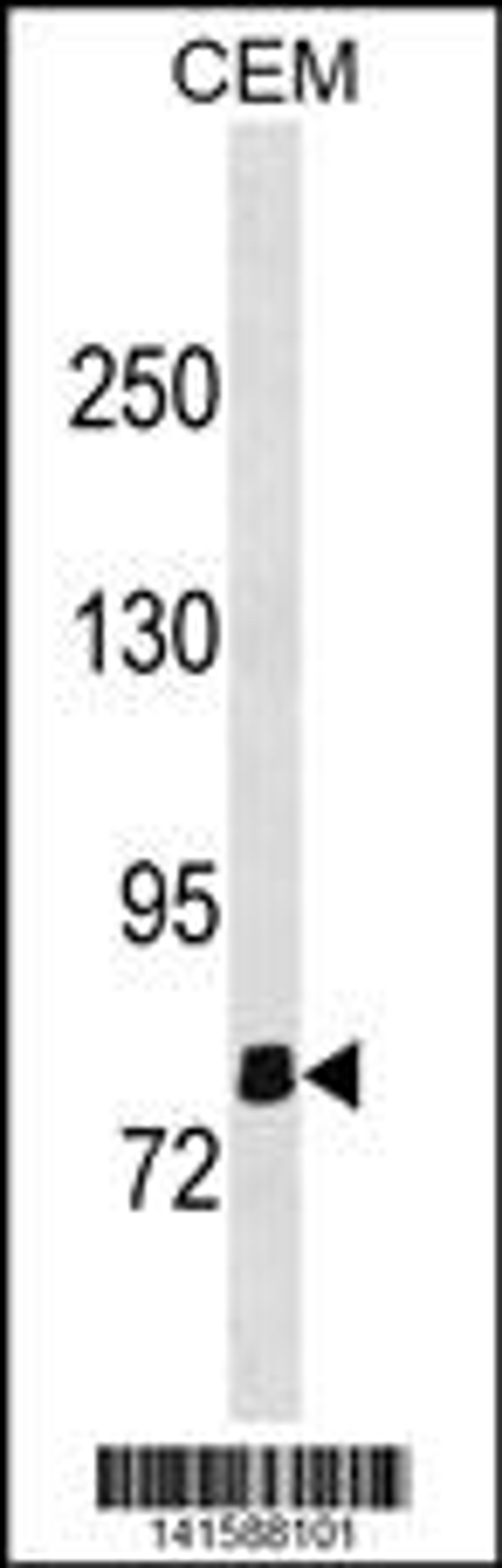 Western blot analysis in CEM cell line lysates (35ug/lane).