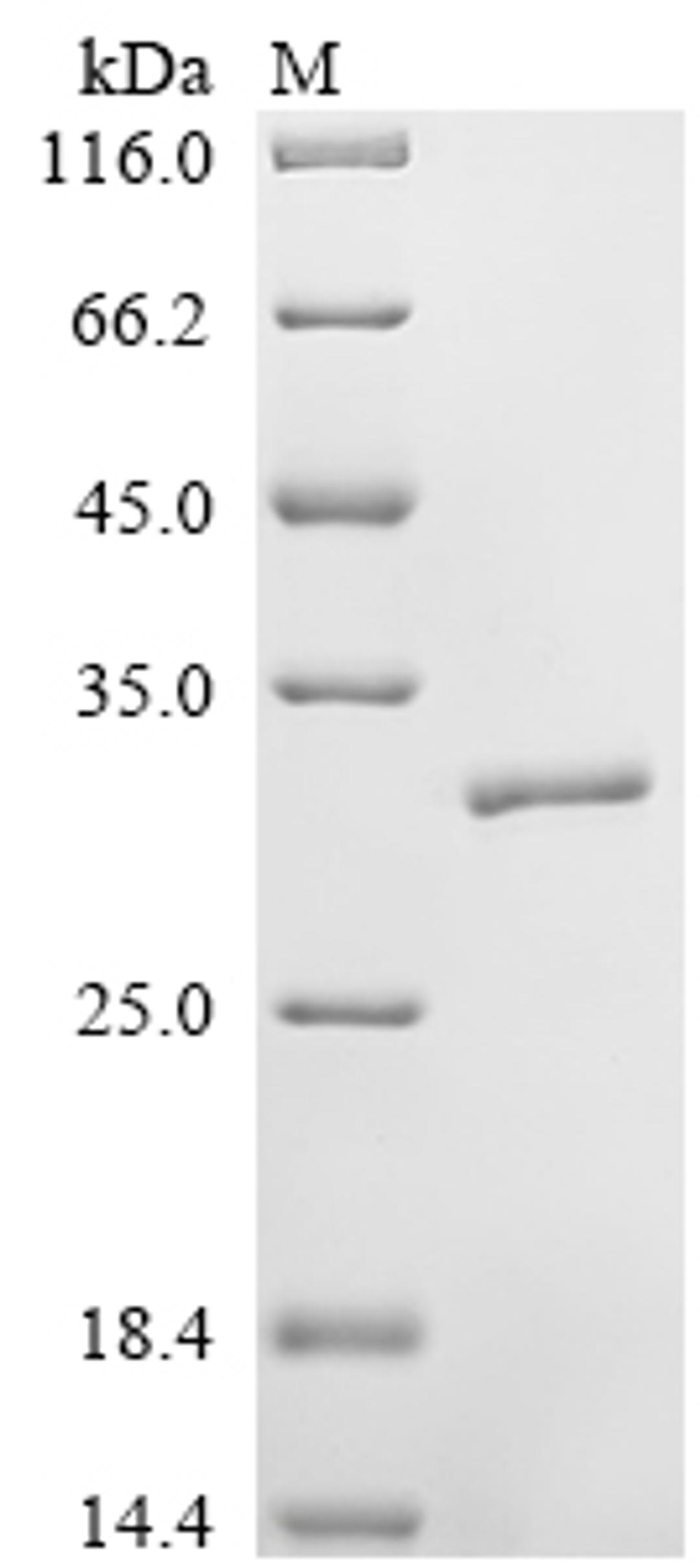 (Tris-Glycine gel) Discontinuous SDS-PAGE (reduced) with 5% enrichment gel and 15% separation gel.