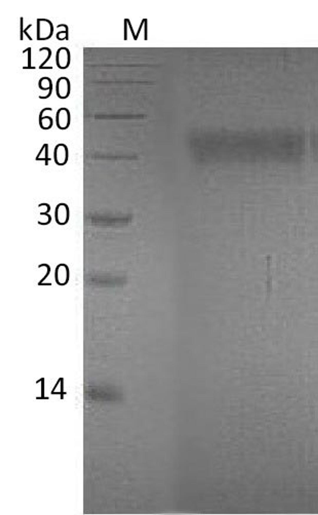 (Tris-Glycine gel) Discontinuous SDS-PAGE (reduced) with 5% enrichment gel and 15% separation gel.