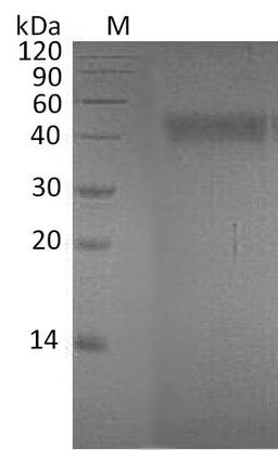 (Tris-Glycine gel) Discontinuous SDS-PAGE (reduced) with 5% enrichment gel and 15% separation gel.