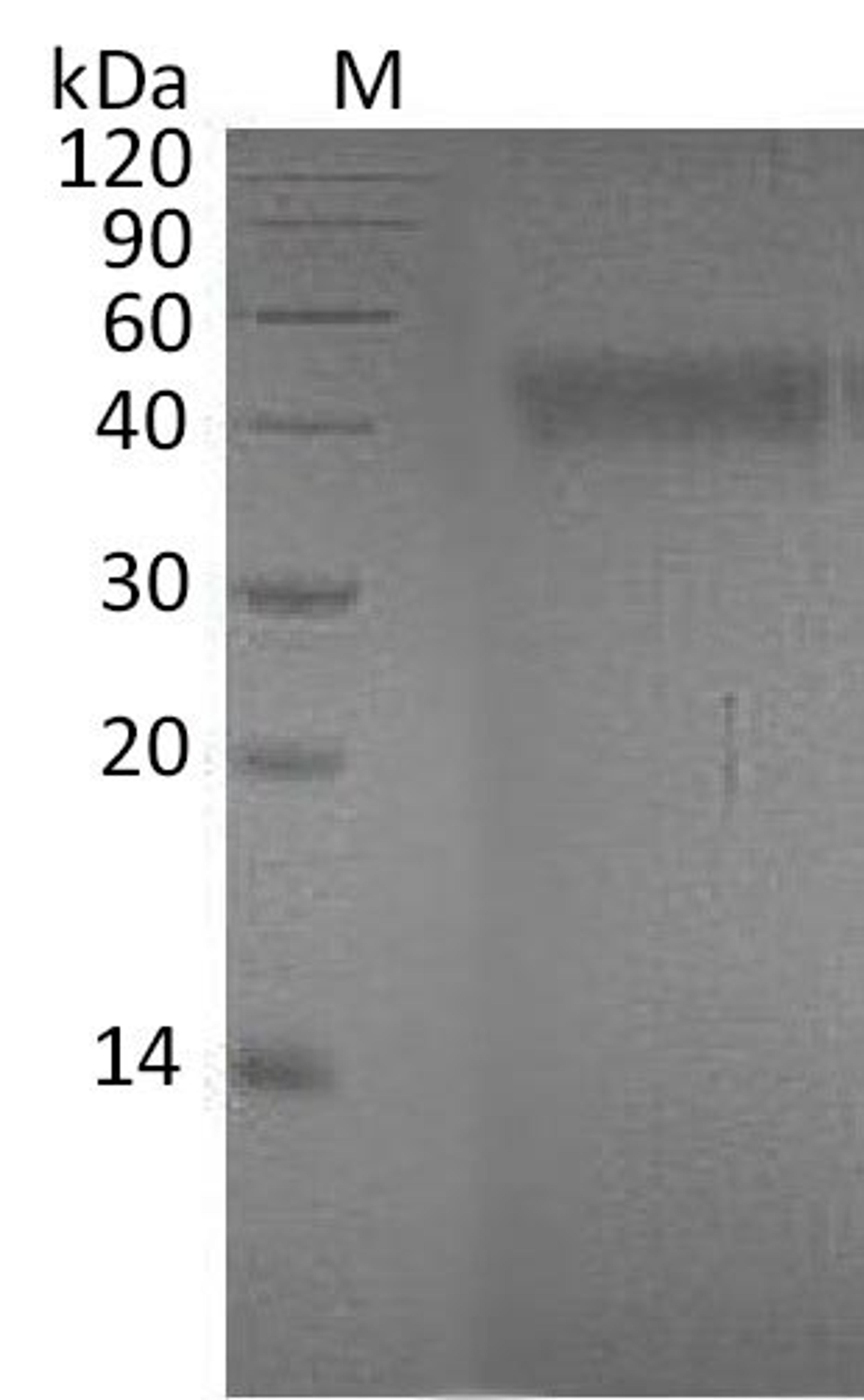 (Tris-Glycine gel) Discontinuous SDS-PAGE (reduced) with 5% enrichment gel and 15% separation gel.